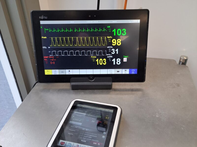 HSC monitoring vitals screen with heart rate, Pulse and Oxygen graphs